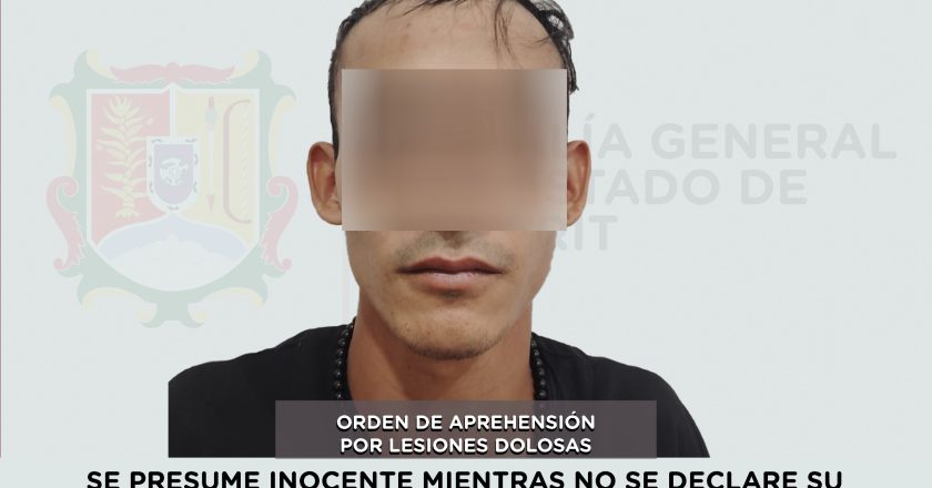 DETENIDO EN COMPOSTELA POR LESIONES DOLOSAS