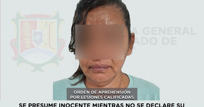 📢 #Boletín | APREHENDIDA EN ACAPONETA POR LESIONES CALIFICADAS