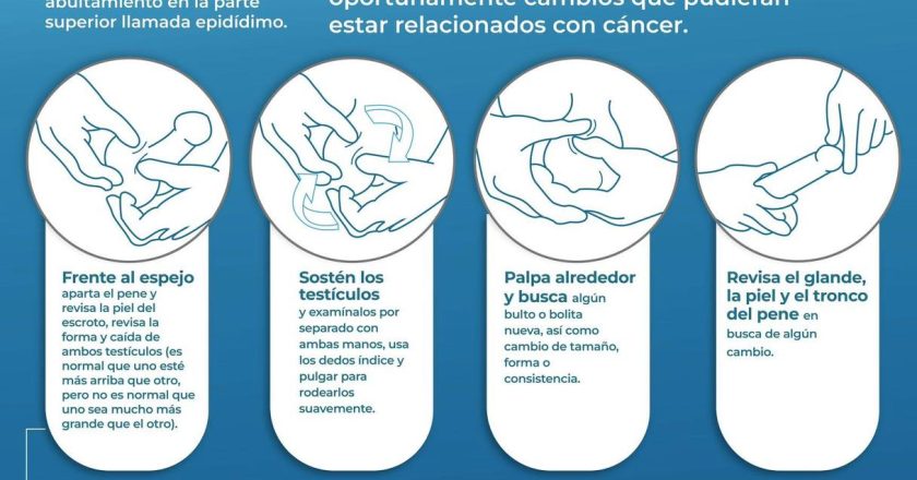 PROMUEVEN LA AUTOEXPLORACIÓN TESTICULAR