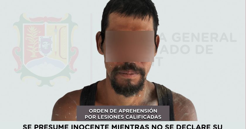 APREHENDIDO EN RUIZ POR EL DELITO DE LESIONES CALIFICADAS