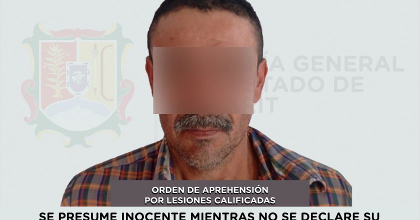 DETENIDO EN SAN PEDRO LAGUNILLAS POR LESIONES CALIFICADAS