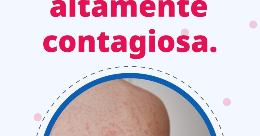 ¡CUIDADO CON EL DENGUE! PREVIENE CRIADEROS DE MOSQUITOS EN CASA
