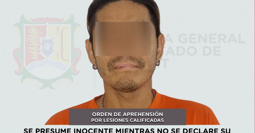 CAPTURADO EN BAHÍA DE BANDERAS POR LESIONES CALIFICADAS