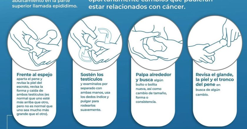 LA AUTOEXPLORACIÓN TESTICULAR PUEDE SALVAR VIDAS